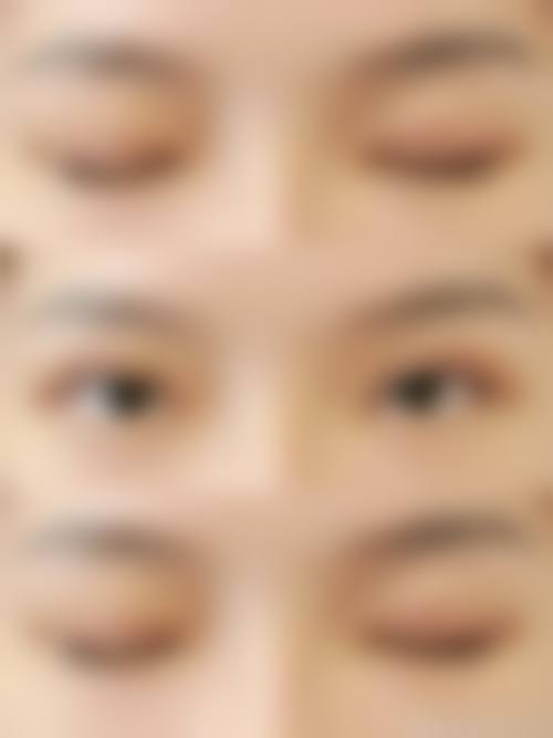 八、阜新朗悦医疗美容门诊部怎么预约?