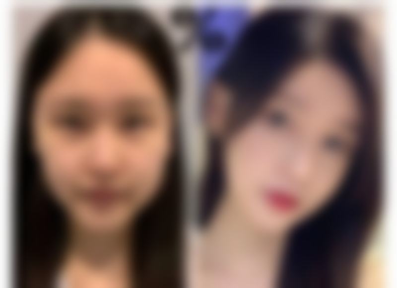 五、北京济诚仁整形医疗美容医院收费价格表