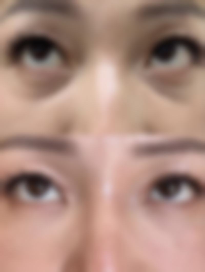 个人体质对修复时间的影响