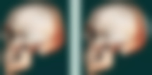 四、韩国dr.bone整形外科特色项目