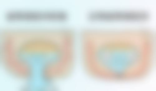 成效持久又安心，让你无后顾之忧