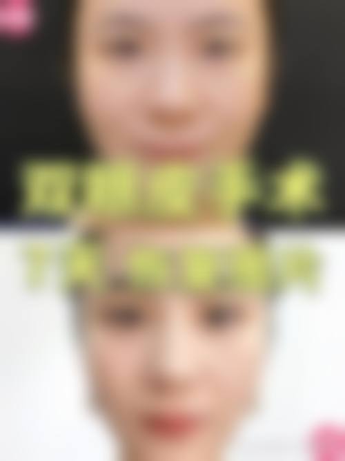 六、海口龙华崔曦文整形口碑如何?