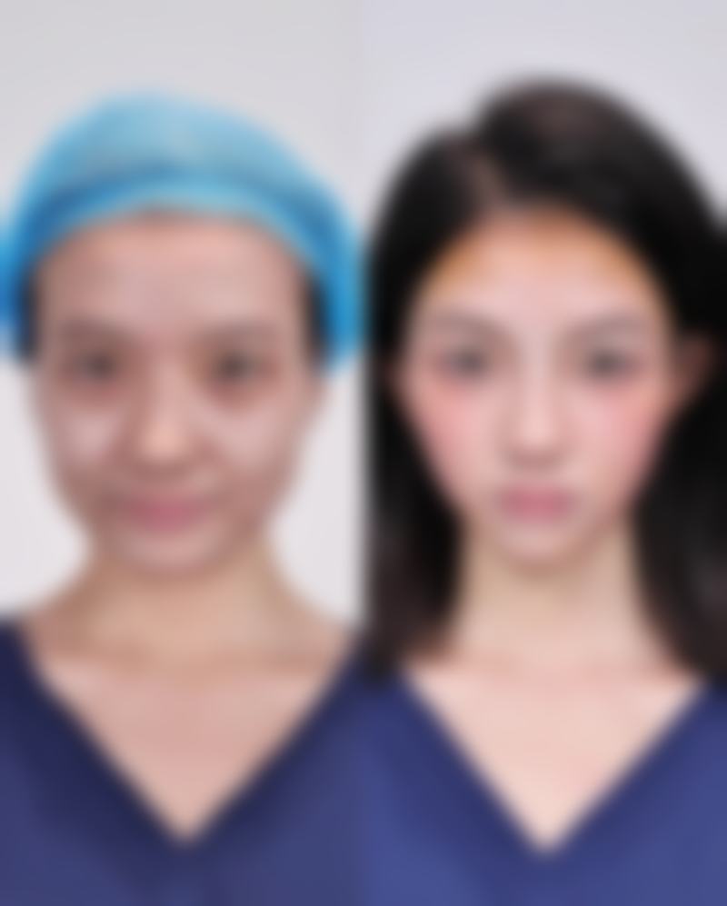 二、上海智美颜和杨欣融医生擅长项目