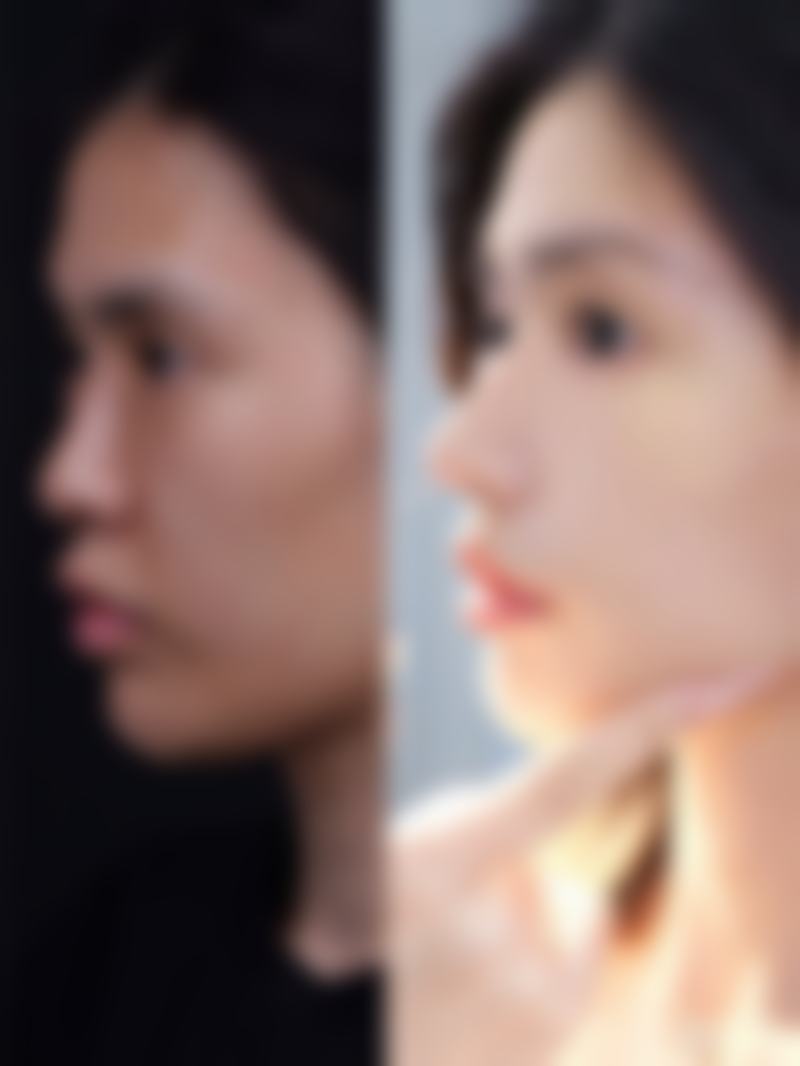 改善眼袋的眼霜成分