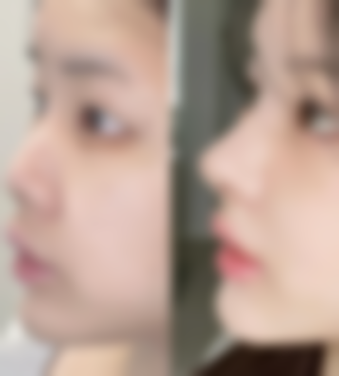 七、上海智美颜和杨欣融医生怎么预约？