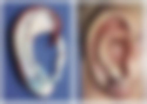 五、北京海医悦美纪勍医生技术怎么样？