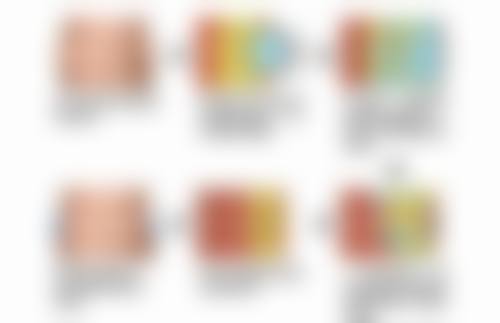 五、北京海医悦美蒋娜医生技术怎么样?