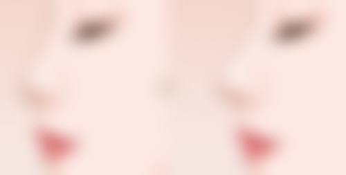 如何治疗油烫伤疤痕？可采用药物涂抹、激光治疗等方法，不同阶段有不同应对策略！ 