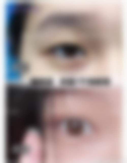 五、上海上实医疗美容医院（外滩SOHO新院区）收费价格表