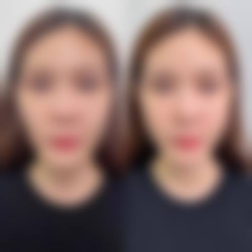 四、烟台贝漾医疗美容整形门诊部特色项目