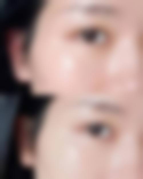 五、烟台美神整形美容医院收费价格表