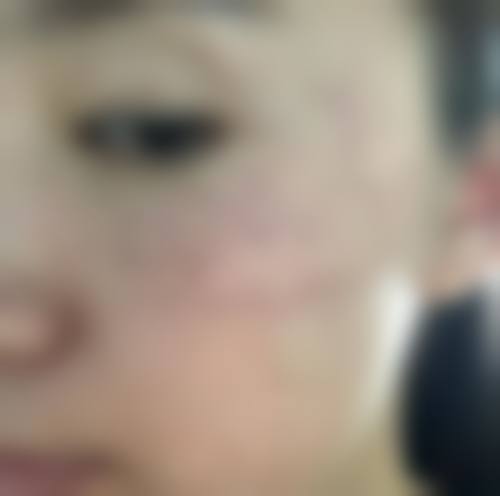 六、河南军区医院激光美容医院整形科口碑如何？