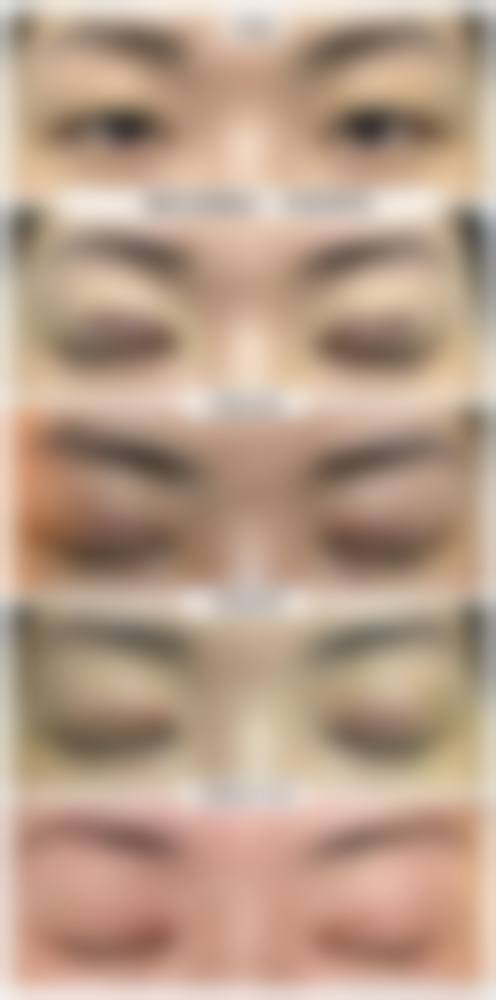 四、河南军区医院激光美容医院整形科特色项目