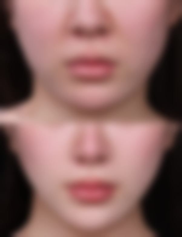 二、诸暨欧莱美整形彭思进医生擅长项目