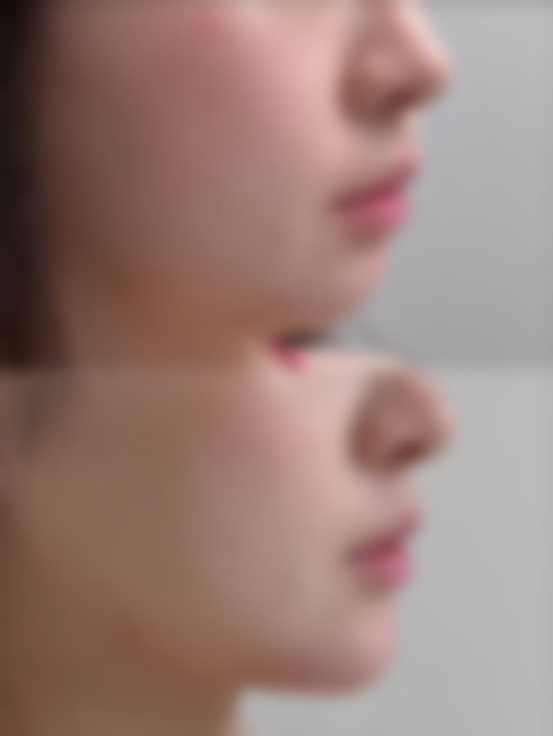 五、厦门厦门大学附属翔安兰俊红医生技术怎么样？