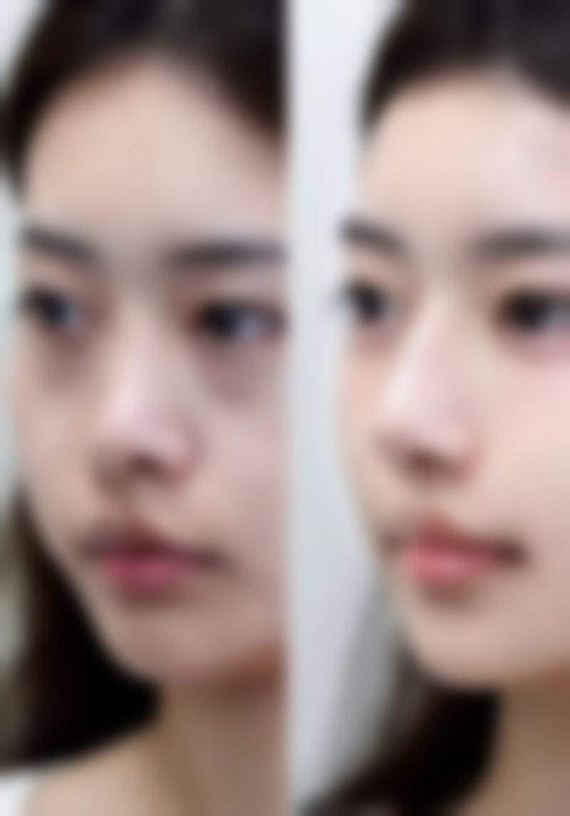 五、长沙一雅医疗美容门诊部收费价格表