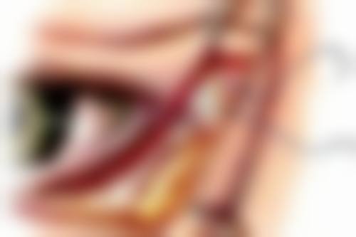 医学手段去除下眼袋