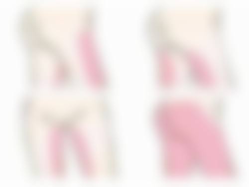 光电治疗红色凹陷疤痕