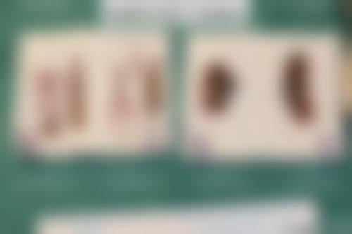 五、武汉江岸诠美整形美容门诊部收费价格表