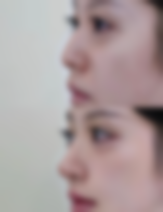 四、韩国朱丽叶整容外科