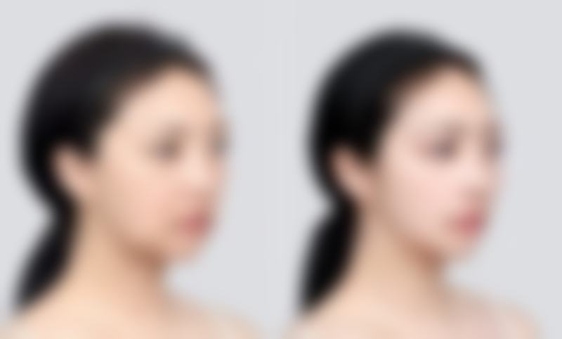 七、韩国朱丽叶整容外科