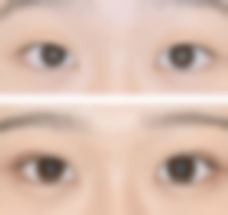 七、上海瑞芙臣整形范小龙医生怎么预约?