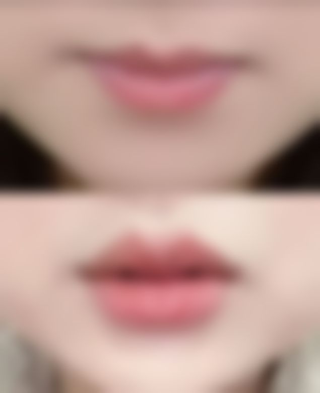 割了双眼皮第二天可以上班吗?这取决于手术方式和工作性质，建议留一周恢复时间哦！ 