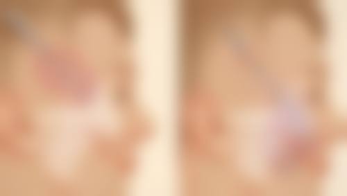 选择生活稳定且环境适宜时手术