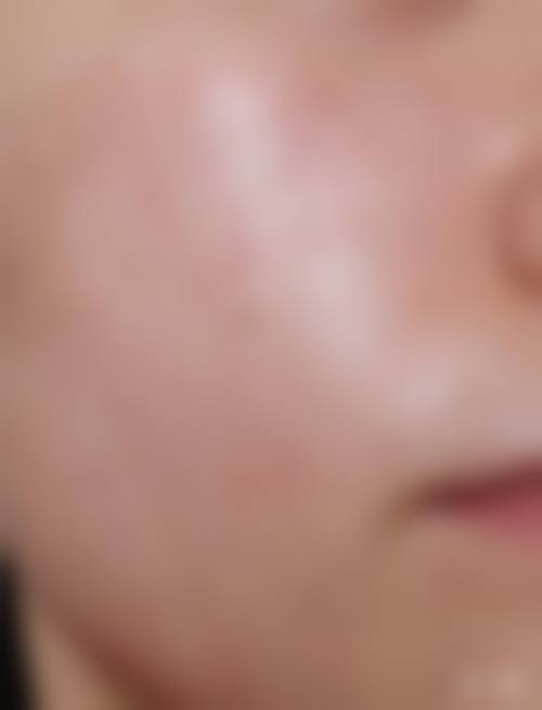 四、成都暄妍医疗美容门诊部特色项目