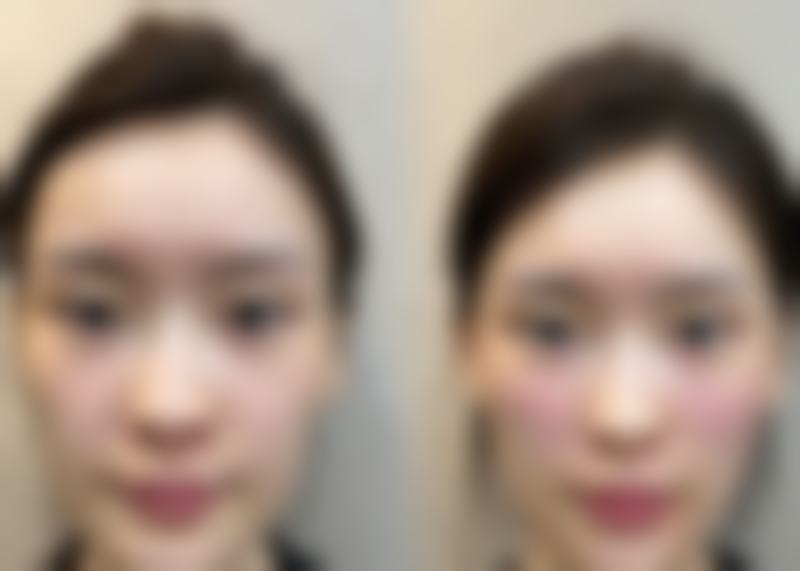 五、长沙浏阳市人民医院医学美容中 心收费价格表