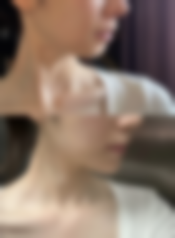 如何确定适合自己的吸脂量