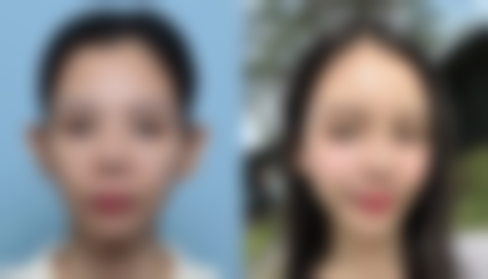 避开经期、孕期和哺乳期