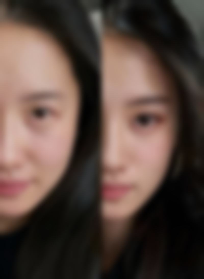 如何判断假体是否需要更换