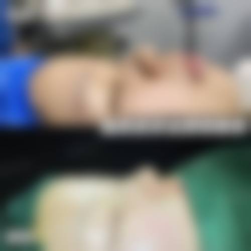 四、南京江宁大西整形医院特色项目