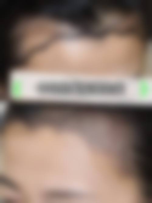 二、青岛雍禾植发医疗美容诊所正规吗？来看医院资质信息