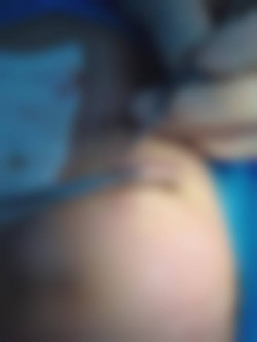 四、安徽省第二人民医院(整形美容烧伤科)特色项目