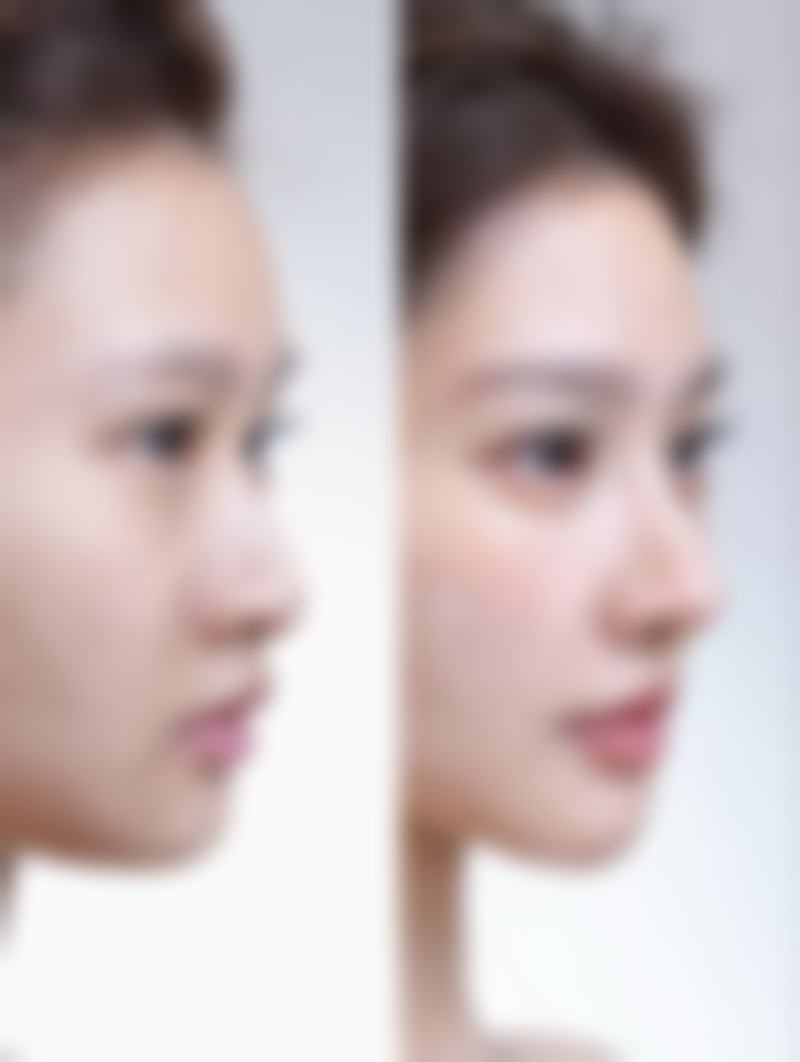 五、南京江宁大西整形医院收费价格表