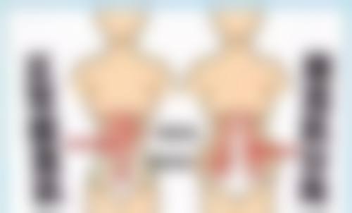 红霉素眼膏为何对眼袋无效