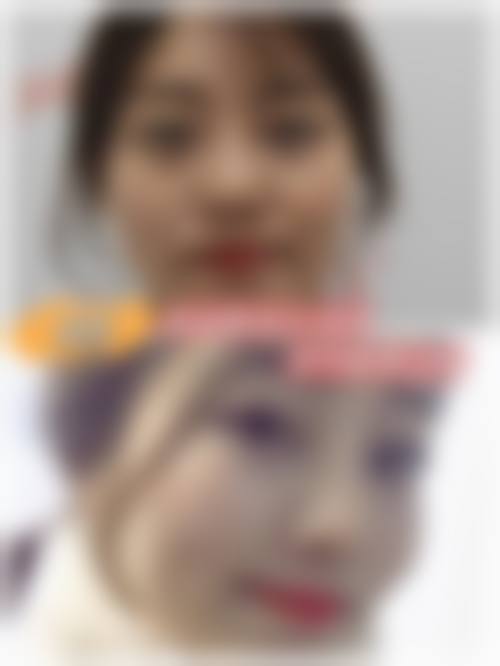 四、郑州善雅医疗美容诊所特色项目