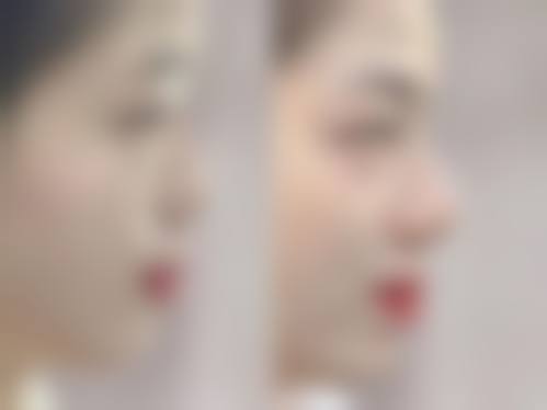 五、兰州明伦医疗美容医院收费价格表