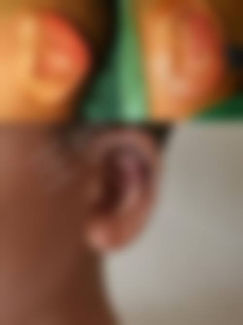 五、东阳玥莱美医疗美容诊所收费价格表