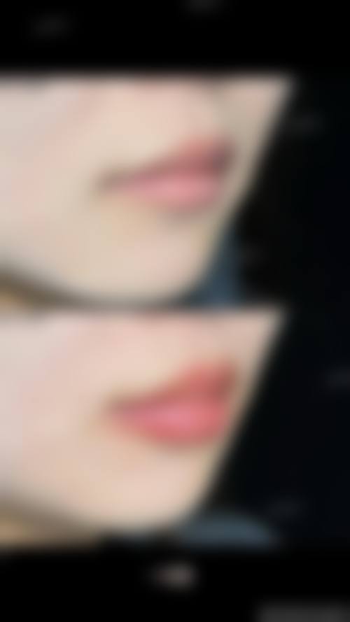 五、郑州善雅医疗美容诊所收费价格表