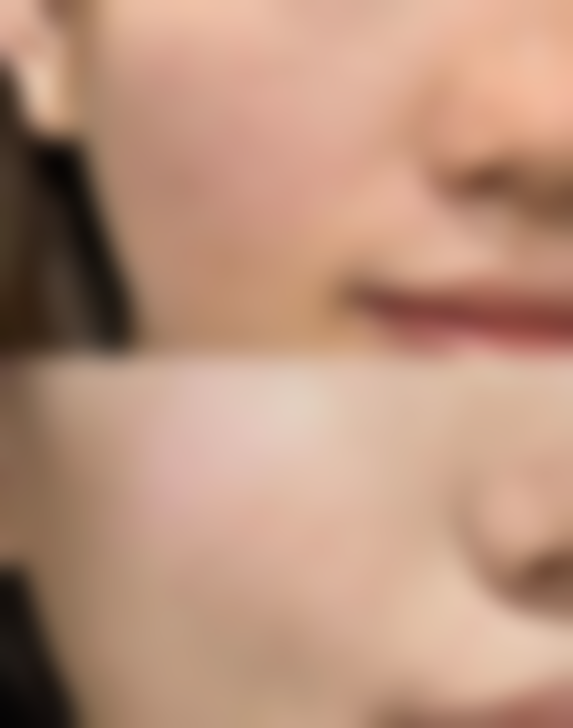 四、汕头曙光整形美容医院特色项目