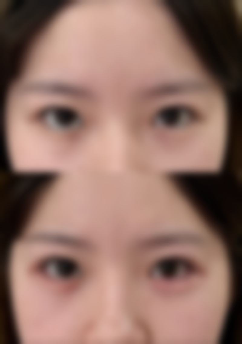 五、佛山顺德乐从医院手足整形外科收费价格表