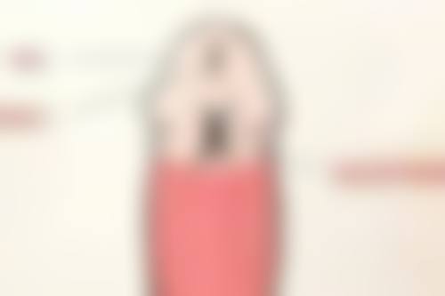 六、深圳港龙医院私密张艳萍医生口碑评价及真人实例反馈