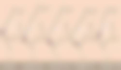 特殊情况修复时间更长