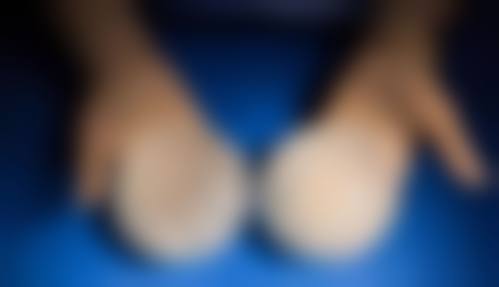 八、成都纽菲斯思整形医院怎么预约？