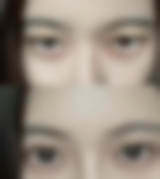 五、俞安娜医生技术怎么样？