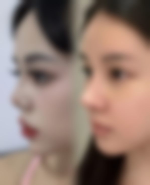 饮食调理:营养均衡,助力修复