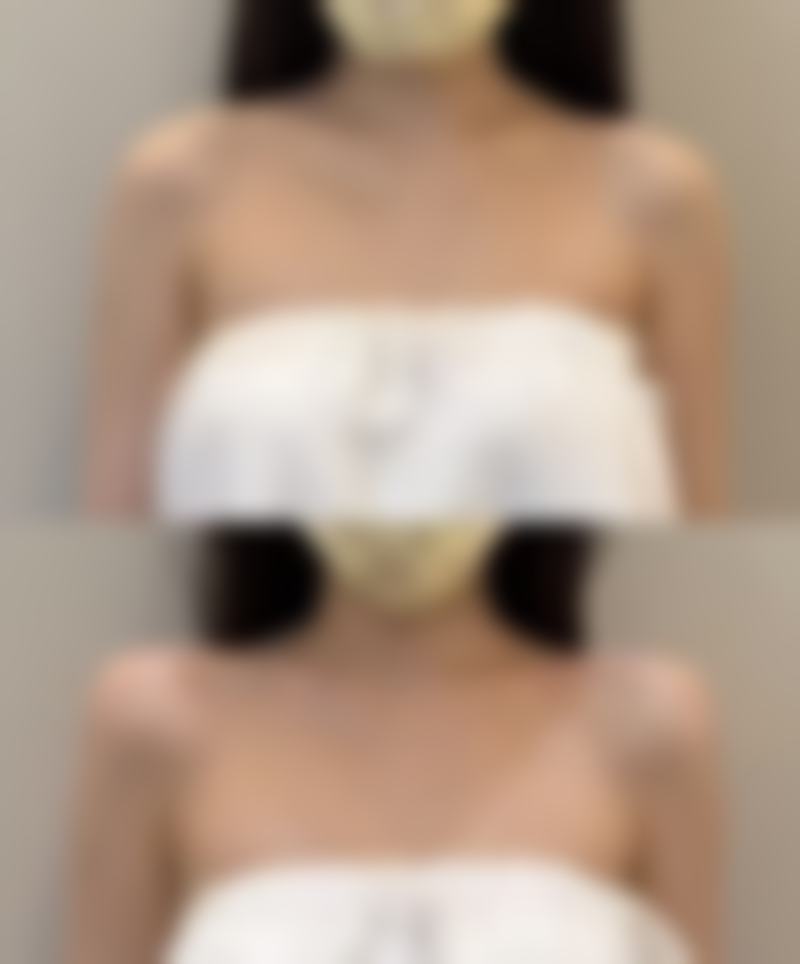 左眼袋一直跳怎么解决？可从物理日常调理、药物治疗着手，严重时还需进阶治疗！ 